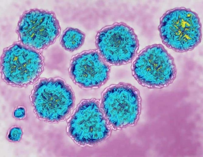 microscopic image of hepatitis c virus