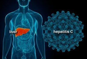 Outline of a man's body with the liver highlighted, next to a hepatitis c viral particle