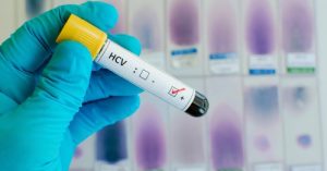HCV Testing