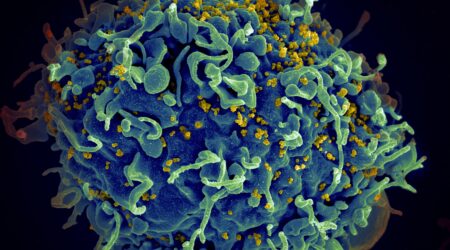 HIV Virus Microscopic View